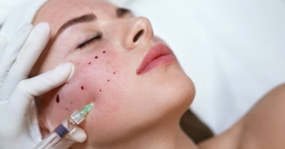 'Vampire' facial would have infected 3 women in the US with HIV.  This we know