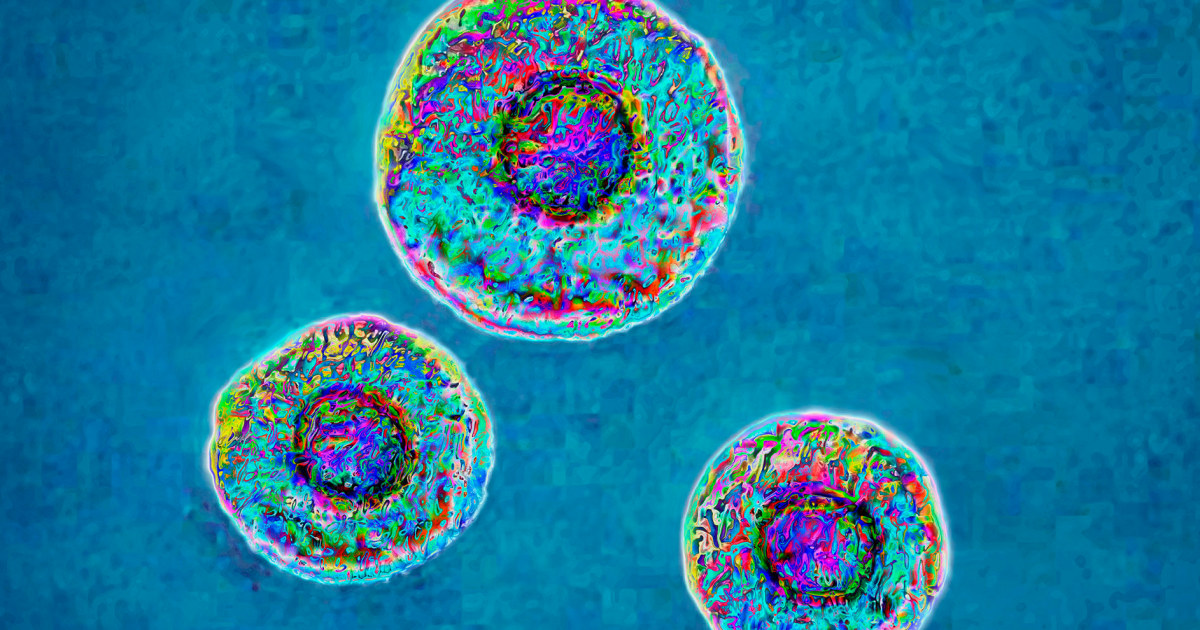 Increase antibiotic resistant bacteria infections in the US