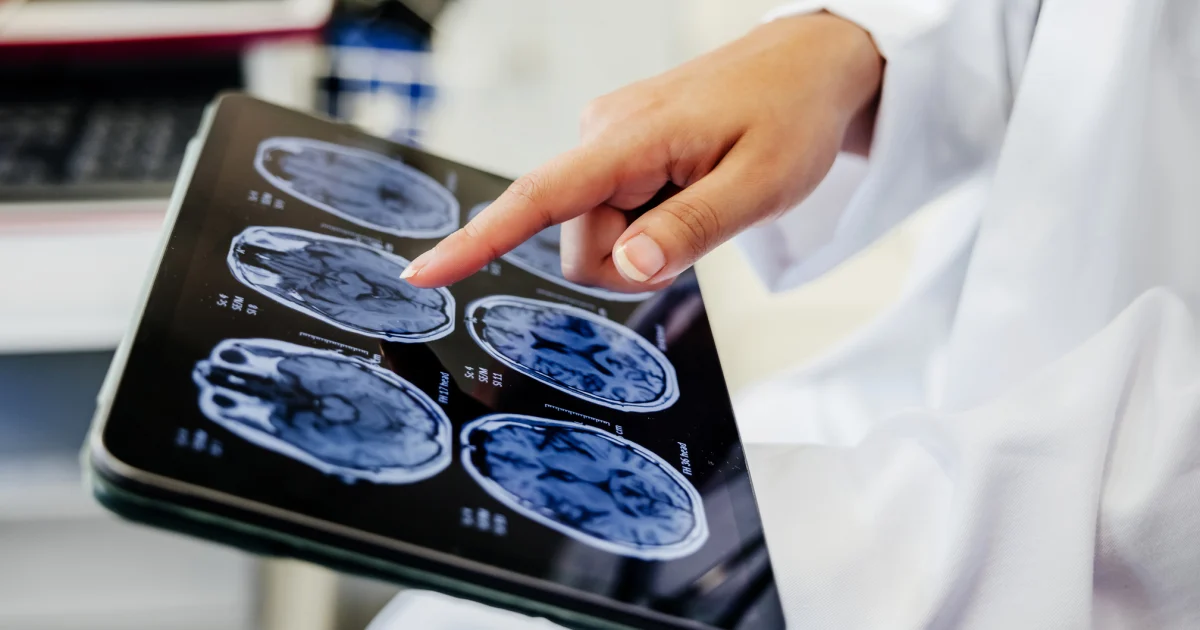 These 10 habits help protect brain health and avoid dementia