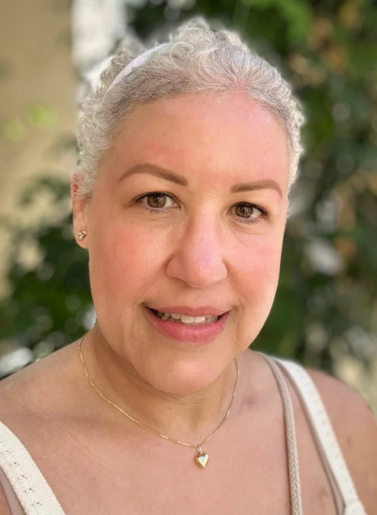 Yenny Olivares with her short hair after going through chemotherapy and receiving the bone marrow transplant. He said that after losing his hair “I didn't see myself in the mirror” and that he didn't speak to anyone for two or three days.