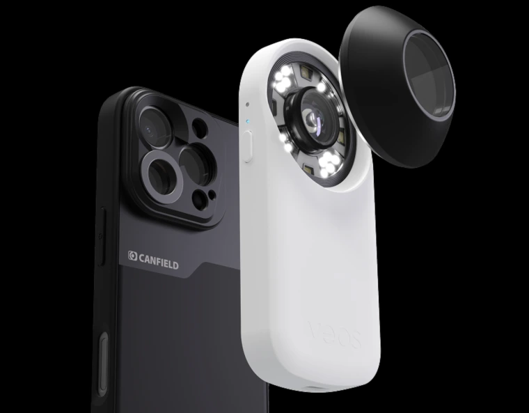 The Rotemberg team's research explores the use of mobile phone cameras, along with this instrument similar to dermoscopy, and the use of artificial intelligence to detect skin cancer.