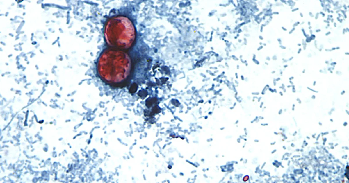The US reports the first two deaths from the cyclosporiasis outbreak that has sickened thousands of people