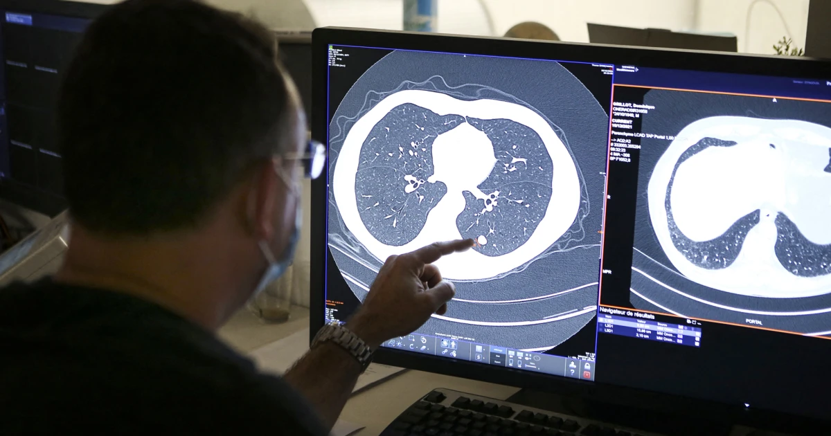 Newly approved pancreatic cancer drug shows promise in treating lung tumors