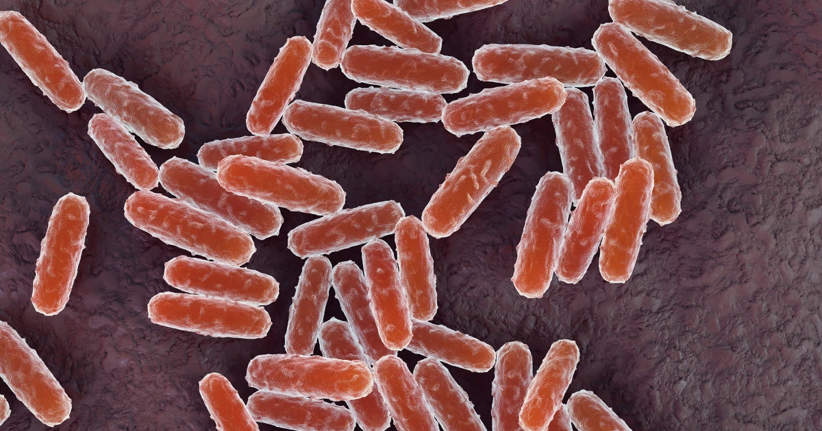 What you should know about pneumonic plague after a woman in Russia dies from a mystery illness